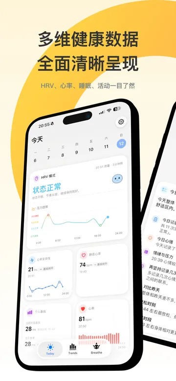 iPhone 上的 Stress 首页,展示 Apple Watch 健康数据